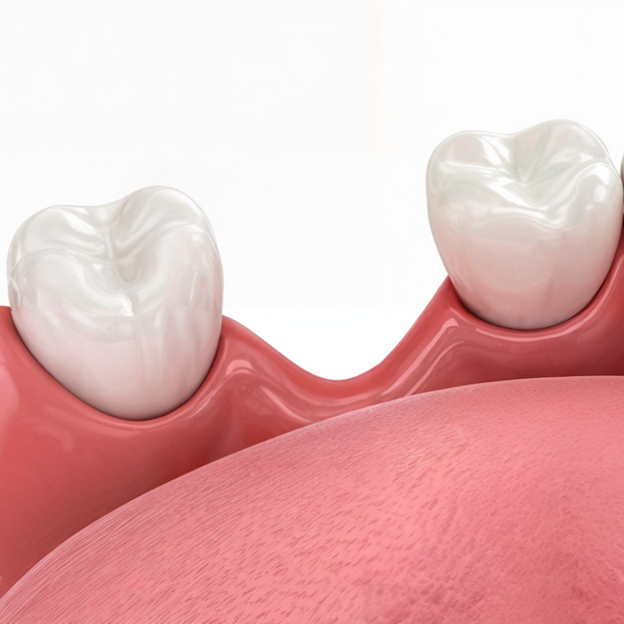 Knocked-Out Tooth Care