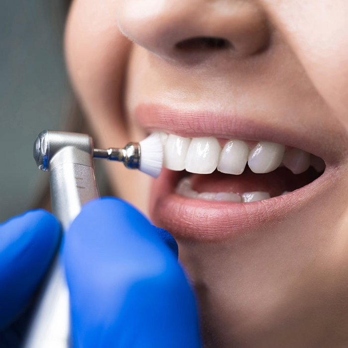 Prophylactic Teeth Cleaning