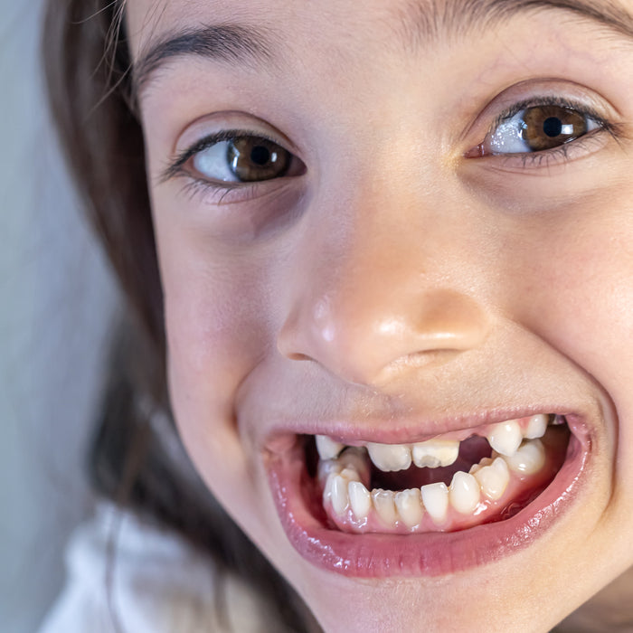 Child's Permanent Teeth Coming In Discolored