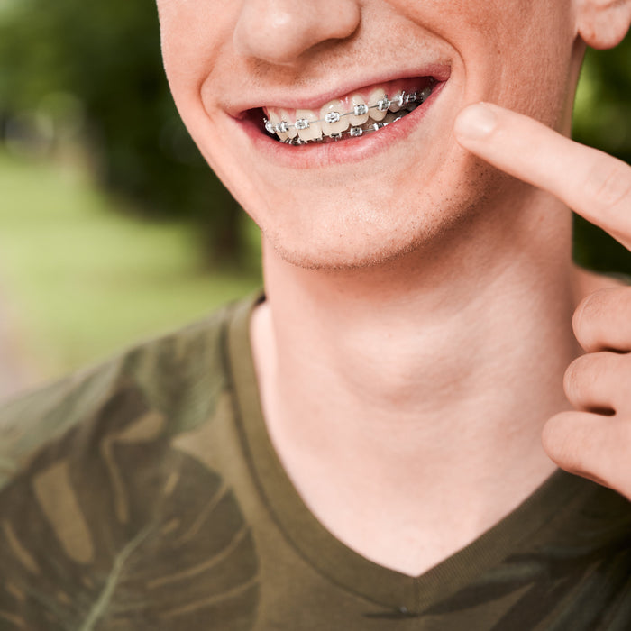 How Long Does Removing Braces Take