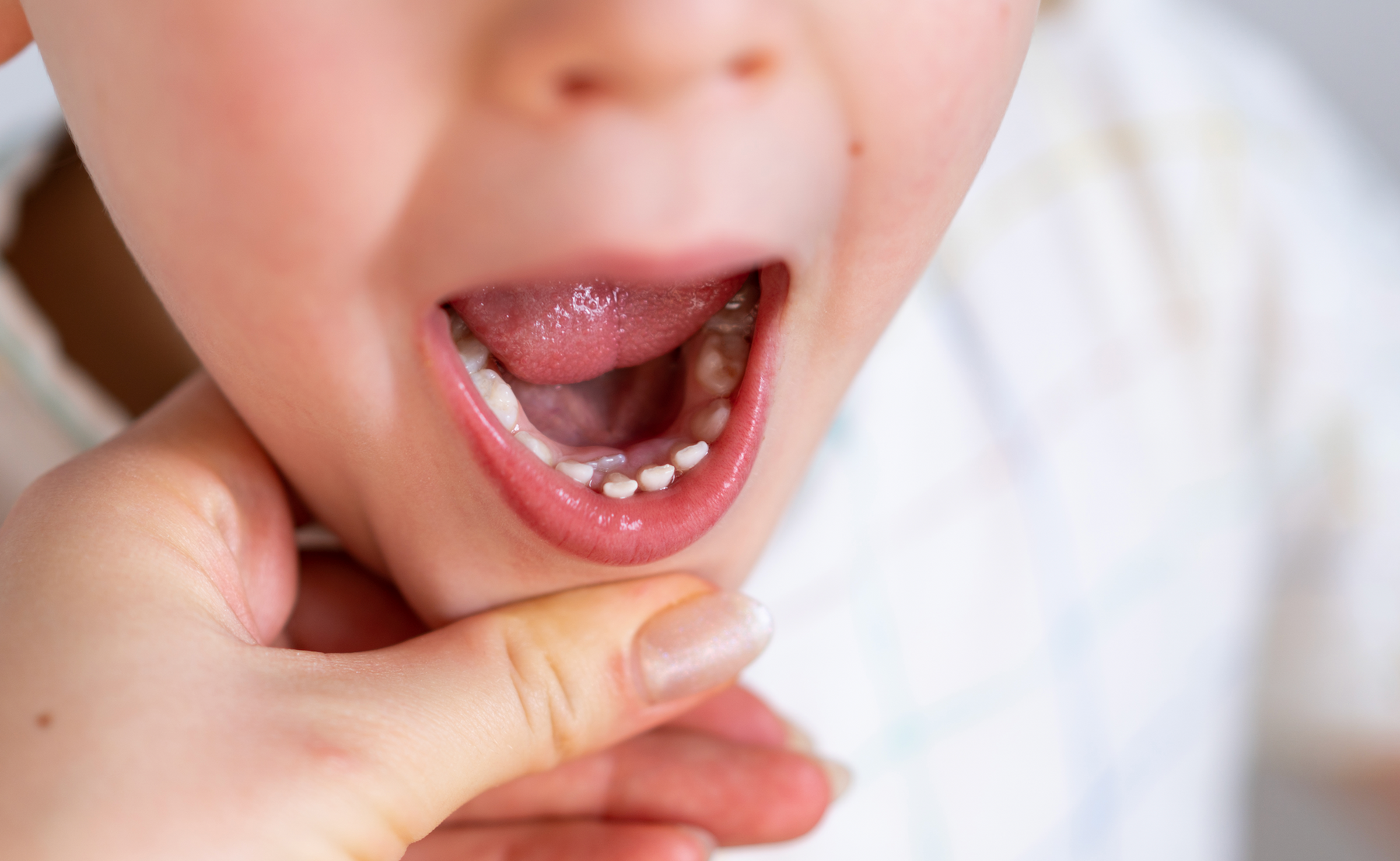 Shark Teeth in Kids