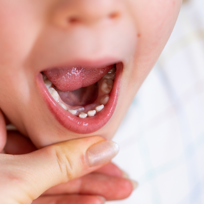 Shark Teeth in Kids