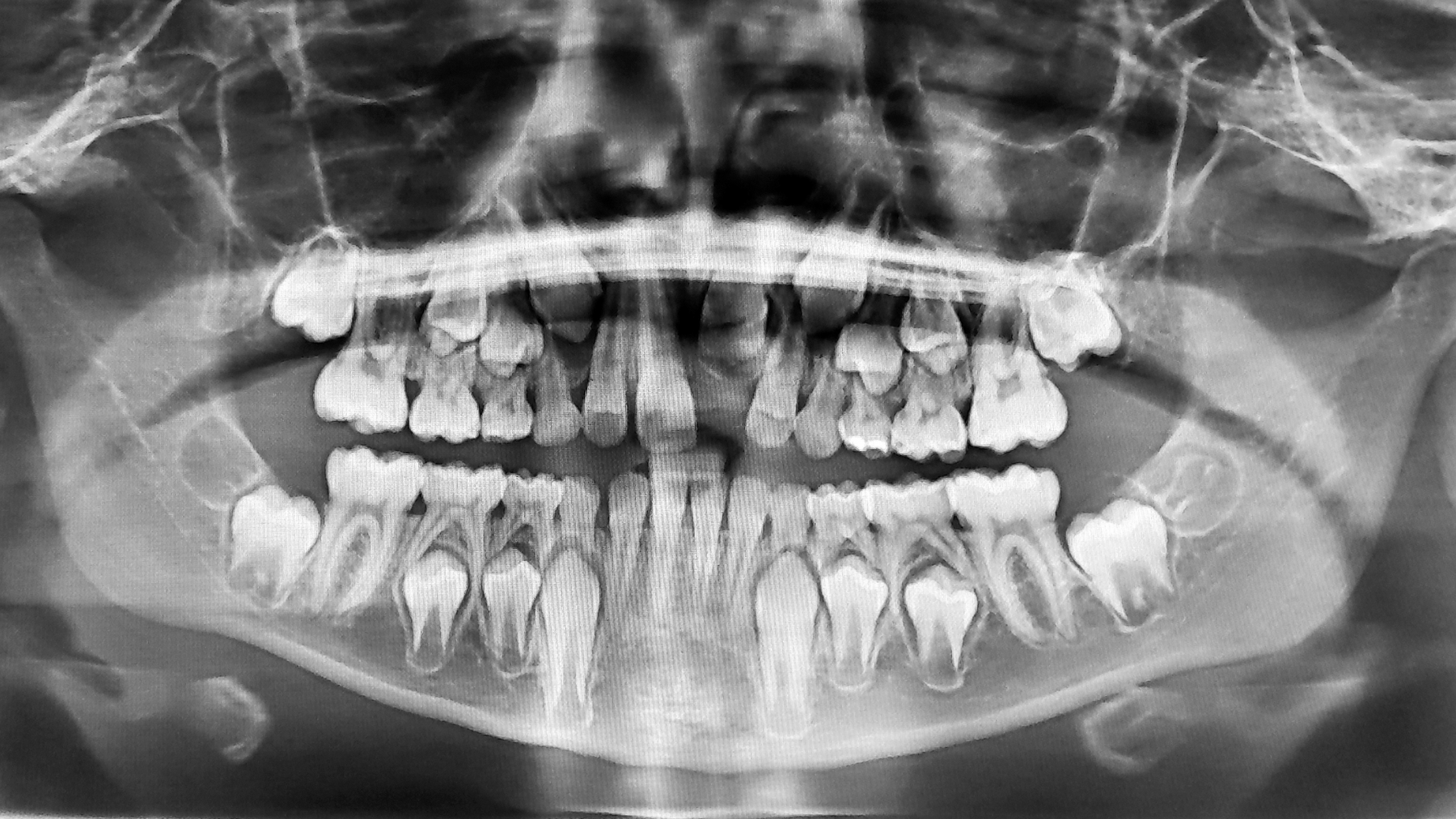Does My Child Have a Dental Emergency?