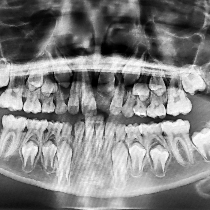 Does My Child Have a Dental Emergency?