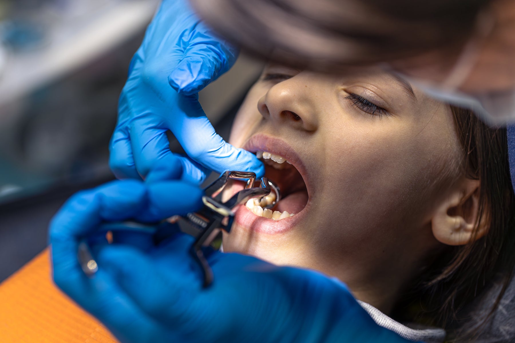 how to heal mouth stitches faster