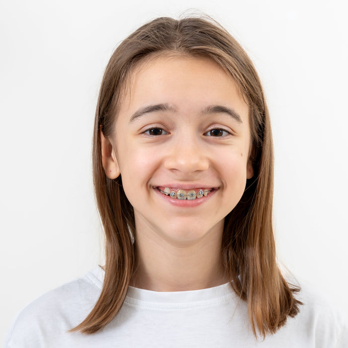 Invisalign vs Braces for Kids