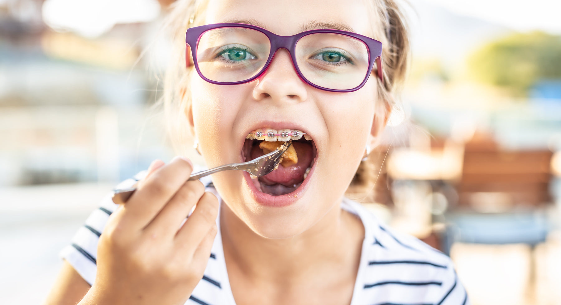 Food You Can Eat With Braces