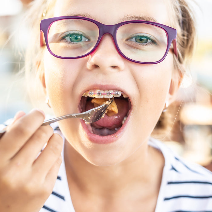 Food You Can Eat With Braces