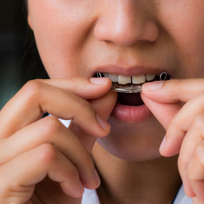 Retainers