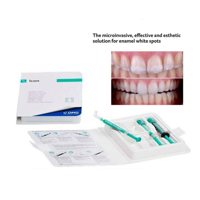 Icon Treatment for Fluorosis Stains